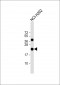 IFNA8 Antibody (C-term)